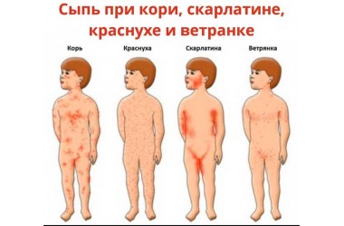 Коронавірус чи ГРВІ? Що потрібно знати?